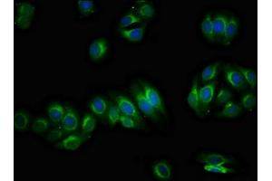 Immunofluorescence staining of HepG2 cells with ABIN7163307 at 1:66, counter-stained with DAPI. (PIRT 抗体  (AA 1-55))