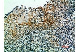 Immunohistochemical analysis of paraffin-embedded human-tonsils, antibody was diluted at 1:200 (IRF3 抗体  (AA 1268-1341))