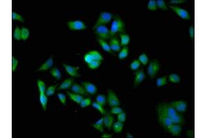 Immunofluorescence staining of Hela cells with ABIN7150124 at 1:100, counter-stained with DAPI. (DDB1 抗体  (AA 741-943))