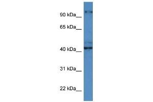 Western Blot showing ATCAY antibody used at a concentration of 1 ug/ml against ACHN Cell Lysate (ATCAY 抗体  (C-Term))