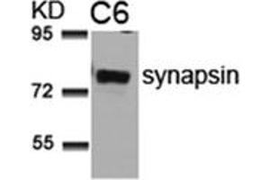 Image no. 1 for anti-Synapsin I (SYN1) (AA 7-11) antibody (ABIN197522) (SYN1 抗体  (AA 7-11))