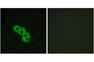Immunofluorescence analysis of MCF7 cells, using GPR109 Antibody. (GPR109 抗体  (AA 285-334))