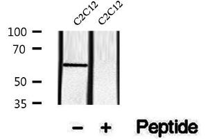Western blot analysis of extracts of C2C12 cells, using Phospho-SQSTM1/p62 (Ser349) Antibody.