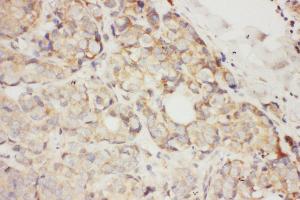 Anti-SCF antibody, IHC(P) IHC(P): Human Mammary Cancer Tissue (KIT Ligand 抗体  (N-Term))