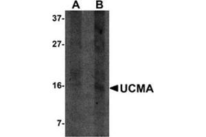 Western blot analysis of UCMA in SW1353 cell lysate with this product at (A) 2. (UCMA 抗体  (C-Term))