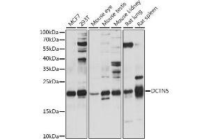 Western blot analysis of extracts of various cell lines, using DCTN5 antibody (ABIN7266853) at 1:1000 dilution.
