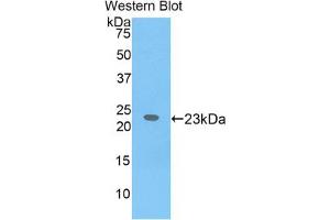 Western blot analysis of the recombinant protein. (IL17 Receptor B 抗体  (AA 310-499))