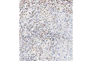 Immunohistochemistry (Paraffin-embedded Sections) (IHC (p)) image for anti-cAMP Responsive Element Binding Protein 1 (CREB1) (pSer133) antibody (ABIN389547)