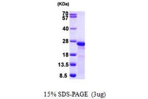 MYL9 Protein (AA 1-172) (His tag)