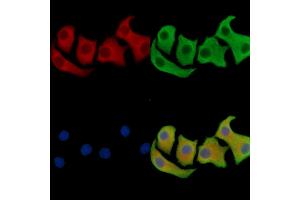 ABIN7096241 and ABIN7100303 staining Hela cells by IF/ICC. (SAMD3 抗体)