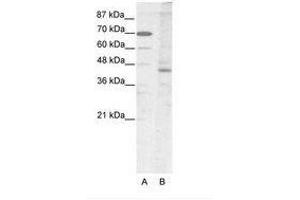 Image no. 1 for anti-LIM Homeobox 2 (LHX2) (AA 251-300) antibody (ABIN202444) (LHX2 抗体  (AA 251-300))