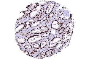 anti-MRE11 Meiotic Recombination 11 Homolog A (S. Cerevisiae) (MRE11A) antibody