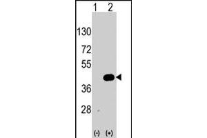 Western blot analysis of WIF1 (arrow) using WIF1 polyclonal antibody . (WIF1 抗体  (AA 350-379))