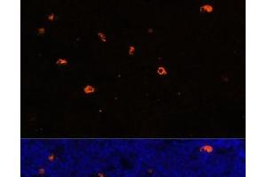 Immunofluorescence analysis of Rat bone marrow using CAMP Polyclonal Antibody at dilution of 1:100. (Cathelicidin 抗体)