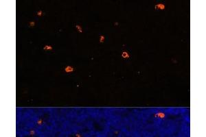 Immunofluorescence analysis of Rat bone marrow using CAMP Polyclonal Antibody at dilution of 1:100.