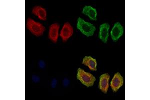 ABIN7094055 and ABIN7098099 staining Hela cells by IF/ICC.