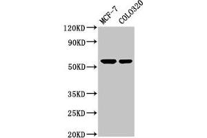 Western Blot Positive WB detected in: MCF-7 whole cell lysate, Colo320 whole cell lysate All lanes: MYOC antibody at 5. (MYOC 抗体  (AA 183-294))