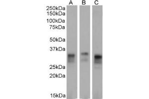 Western Blot using anti-major Prion protein antibody 3F4. (Recombinant PRNP 抗体)