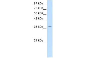 ZNF550 antibody (20R-1242) used at 0. (ZNF550 抗体  (Middle Region))