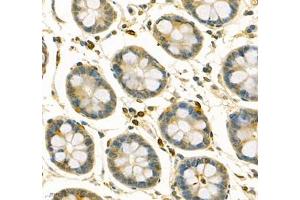 Immunohistochemistry of paraffin embedded human colon using ANXA3 (ABIN7073065) at dilution of 1: 200 (400x lens) (Annexin A3 抗体)
