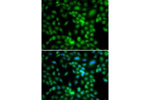 Immunofluorescence analysis of MCF7 cell using SYCE1 antibody. (SYCE1 抗体)