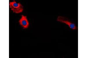 Immunofluorescent analysis of Gastrin staining in HeLa cells. (Gastrin 抗体  (Center))