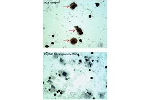 Sample type -- oral cell carcinoma Dilution -- 5ug/mL