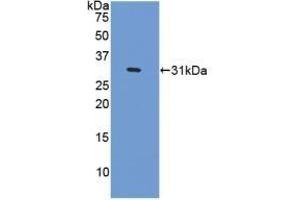 Detection of Recombinant CENPI, Human using Polyclonal Antibody to Centromere Protein I (CENPI) (CENPI 抗体  (AA 292-528))