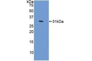 Detection of Recombinant CENPI, Human using Polyclonal Antibody to Centromere Protein I (CENPI)