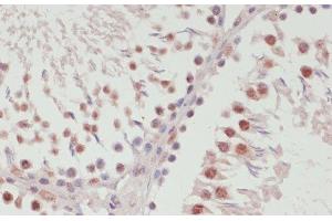 Immunohistochemistry of paraffin-embedded Rat testis using SNRNP70 Polyclonal Antibody at dilution of 1:100 (40x lens). (SNRNP70 抗体)