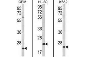 Western blot analysis of KLRC2 Antibody (N-term) from left to right in CEM, HL-60, K562 cell line lysates (35ug/lane). (KLRC2 抗体  (N-Term))