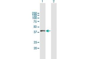 Western Blot analysis of ASGR2 expression in transfected 293T cell line by ASGR2 MaxPab polyclonal antibody. (Asialoglycoprotein Receptor 2 抗体  (AA 1-287))