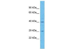 Western Blotting (WB) image for anti-Olfactory Receptor, Family 4, Subfamily N, Member 5 (OR4N5) (C-Term) antibody (ABIN2791744) (OR4N5 抗体  (C-Term))