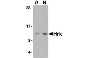 Western blot analysis of Hrk in mouse pancreas tissue lysate with AP30395PU-N Hrk antibody at (A) 2. (HRK 抗体  (Center))