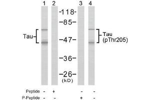Image no. 2 for anti-Microtubule-Associated Protein tau (MAPT) (pThr205) antibody (ABIN196803) (MAPT 抗体  (pThr205))