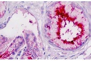 Human Pancreatic Duct: Formalin-Fixed, Paraffin-Embedded (FFPE) (PLA2G7 抗体)