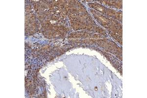 IHC analysis of PIG3/TP53I3 using anti-PIG3/TP53I3 antibody (ABIN7599280). (TP53I3 抗体  (AA 1-332))