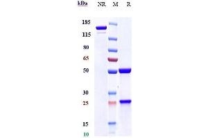 Anti-Mesothelin Reference Antibody (amatuximab) on SDS-PAGE under reducing (R) condition. (Recombinant Mesothelin (Amatuximab Biosimilar) 抗体)