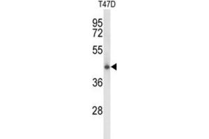 Western Blotting (WB) image for anti-Ceroid-Lipofuscinosis, Neuronal 5 (CLN5) antibody (ABIN3003962) (CLN5 抗体)