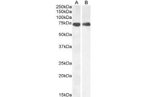 Western Blotting (WB) image for anti-Prostaglandin-Endoperoxide Synthase 1 (Prostaglandin G/H Synthase and Cyclooxygenase) (PTGS1) (C-Term) antibody (ABIN184671)