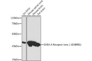Western blot analysis of extracts of various cell lines, using GABA A Receptor beta 1 (G) (G) Rabbit mAb (ABIN7267345) at 1:1000 dilution. (GABRB1 抗体)
