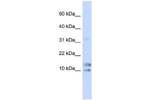IL15 antibody used at 1 ug/ml to detect target protein.
