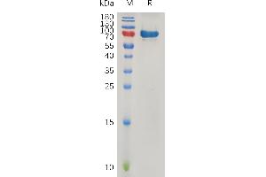 SDS-PAGE (SDS) image for Secreted Protein, Acidic, Cysteine-Rich (Osteonectin) (SPARC) protein (Fc Tag) (ABIN7490955)
