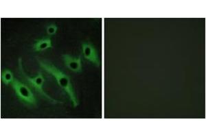 Immunofluorescence analysis of HeLa cells, using HER2 Antibody. (ErbB2/Her2 抗体  (AA 641-690))