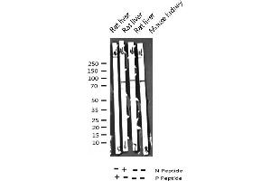 Western blot analysis of Phospho-STAT6 (Tyr641) expression in various lysates (STAT6 抗体  (pTyr641))