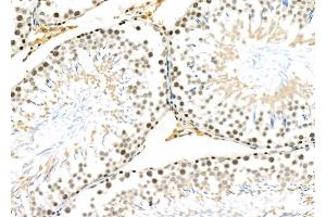 ABIN6258098 and ABIN6273477 at 1/100 staining Rat testis tissue by IHC-P. (CYLC1 抗体)