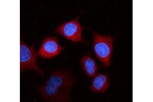 IF analysis of Fibrinogen beta chain/FGB using anti-Fibrinogen beta chain/FGB antibody (ABIN4886579).
