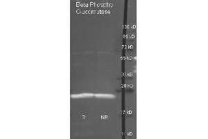 Goat anti antibody  was used to detect purified Beta Phospho Glucomutase under reducing (R) and non-reducing (NR) conditions. (Beta-Phosphoglucomutase 抗体  (Biotin))