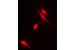 Immunofluorescent analysis of Histone Deacetylase 6 (pS22) staining in Hela cells. (HDAC6 抗体  (N-Term, pSer22))