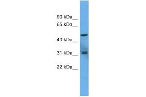 WB Suggested Anti-ADCYAP1R1 Antibody Titration: 0. (ADCYAP1R1 抗体  (C-Term))